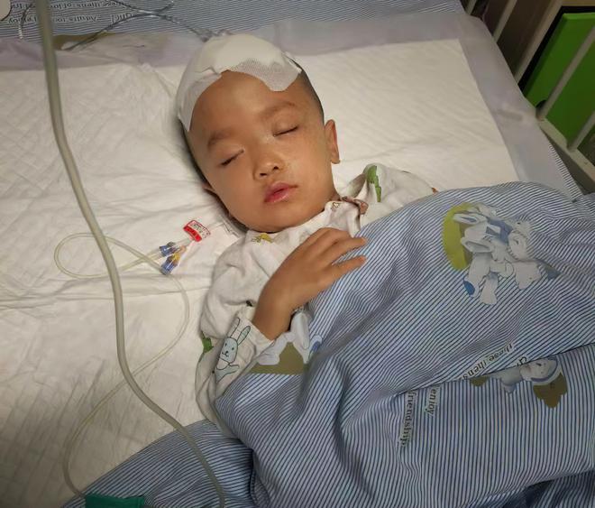熊猫体育·(中国)官方网站男童经常摔跤开颅后发现脑袋里有特殊东西装上“抽水泵”保(图9)