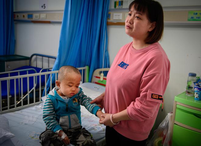 熊猫体育·(中国)官方网站男童经常摔跤开颅后发现脑袋里有特殊东西装上“抽水泵”保(图11)