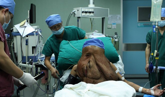 熊猫体育实拍“象面人”的生活日常脸部似怪物有人想买走卖票参观。(图2)